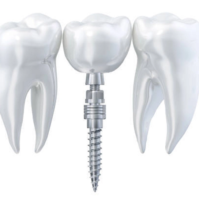 Titanium Rod Medical