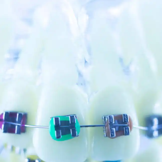 medical grade titanium wire